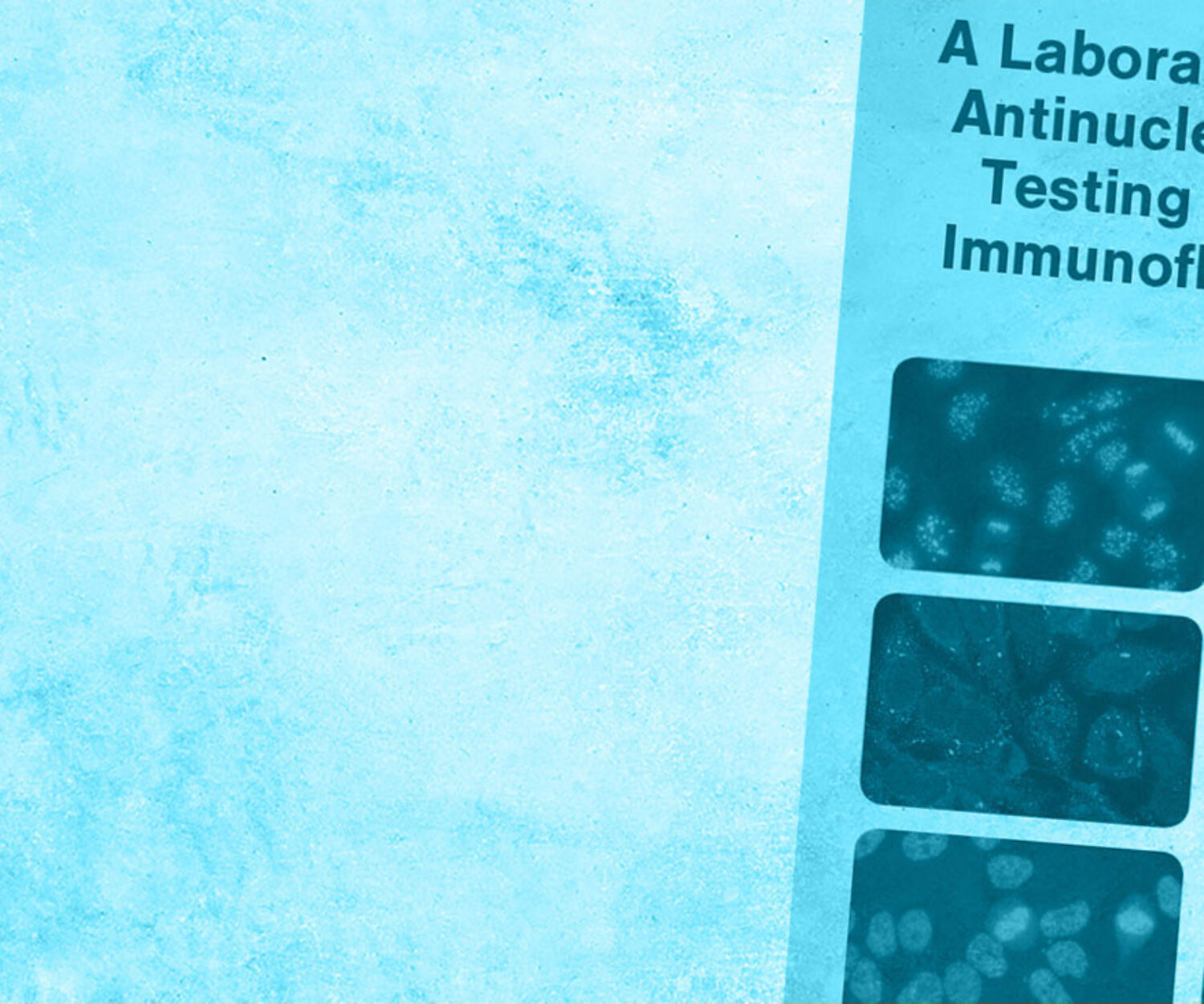 EuroImmun Custom Booklet on blue background