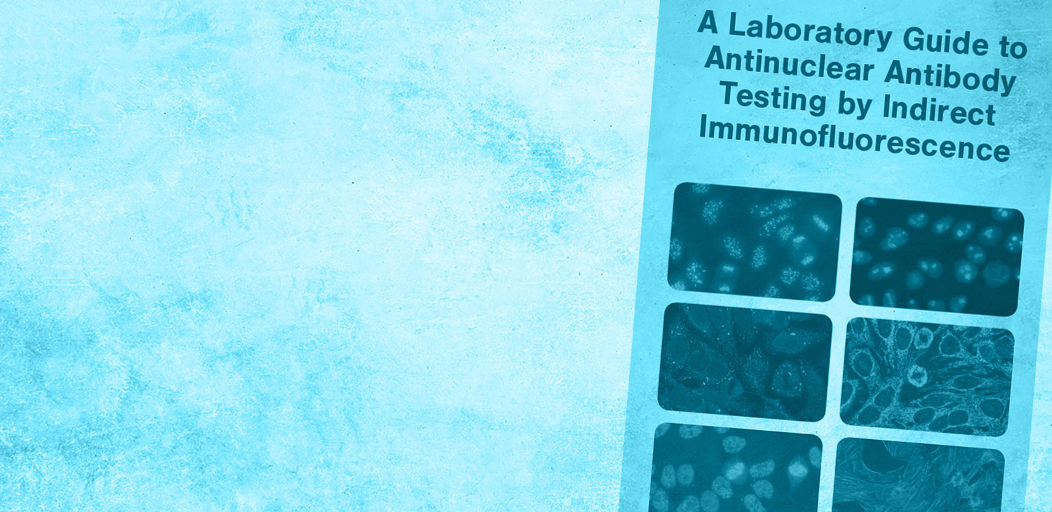 EuroImmun US vncreative